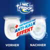Zwei Toilettenansichten zeigen den Unterschied vor und nach der Anwendung des WC-Reinigers.